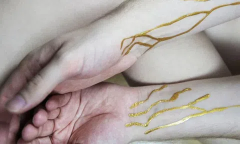 Nhóm máu và nguy cơ đột quỵ sớm: Góc nhìn sức khỏe cho những người yêu dịch chuyển